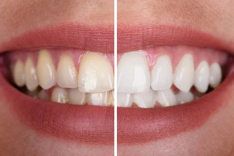 Purple Toothpaste